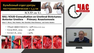 «Час с ведущим урологом». Выбор оптимального метода уретропластики при стриктурах у мужчин