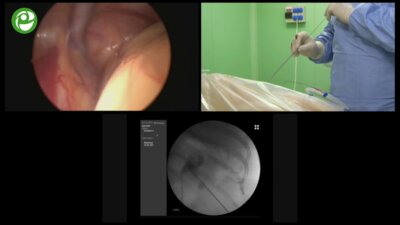 Секция живой хирургии №2