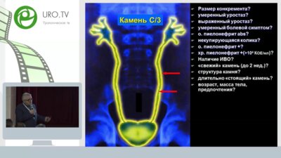 Круглый стол - ДЛТ и уретероскопия - за и против?