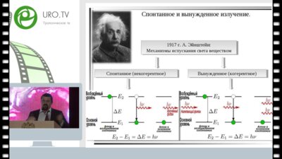 Мазуренко Д.А. - Лазерная литотрипсия – вчера, сегодня, завтра