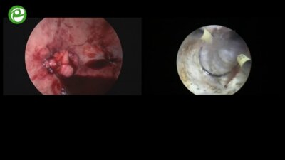 Секция живой хирургии №4