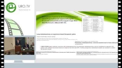 Смоленов Е.И. - Оптимизация подходов к хирургии внутрилегочных метастазов