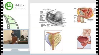 Ярин Г.Ю. - К вопросу организации нейроурологической помощи