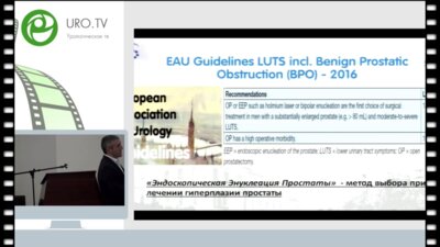 Еникеев Д.В. - Тулиевая лазерная энуклеация гиперплазии простаты
