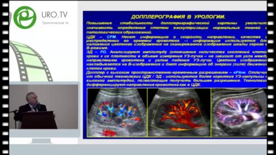 Рязанцев А.А. - Новые возможности ультразвуковой визуализации в урологии