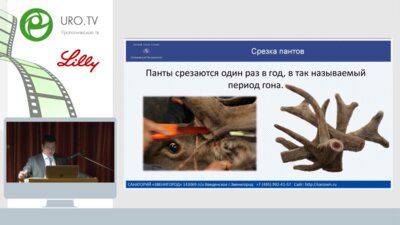 Коваленко А.А. - Пантовые ванны санатория Звенигород  уникальные возможности реабилитации