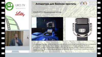 Ахвледиани Н.Д. - Аденомэктомия и радикальная простатэктомия: расстройства мочеиспускания и ЭД