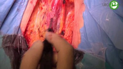 Операция Йохансон (1-й этап) - Котов С.В.