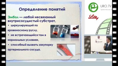 Неймарк Б.А. - Что должен знать уролог о больном после эмболизации простатических артерий по поводу аденомы простаты