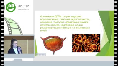 Мартьянова Н.А. - Суперселективная эмболизация простатических артерий в лечении ДГПЖ