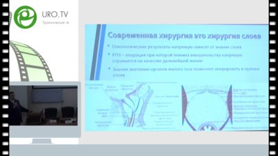 Безруков Е.А. - «Milestones» лапароскопической и робот-ассистированной радикальной простатэктомии