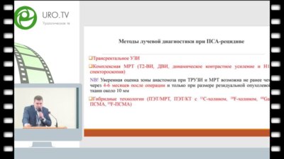 Пахомов А.Ю. - Сравнение ПЭТ КТ с 68GA ПСМА и 11С- холином у больных РПЖ