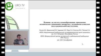 Джалилов И.Б. - Влияние на частоту камнеоброазования примнения механических сшивающих аппаратов