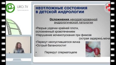 Григорьева М.В. - Неотложные состояния в детской андрологии