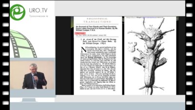 Осипов И.Б. - Успешный результат малоинвазивного лечения спрингоцеле куперовой железы