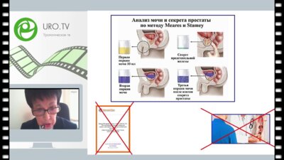 Кузнецова Н.Н. - Хронический простатит и материал для его исследований