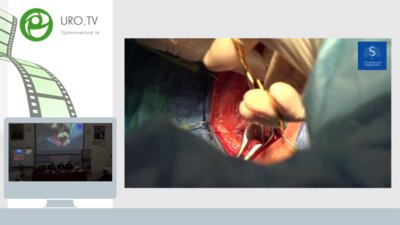 Бутнару Д.В., Безруков Е.А., Еникеев М.Э. - Видеосессия Живая хирургия