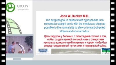 Каганцов И.М - Прогнозирование отдаленных результатов применения современных методик уретропластики при гипоспадии у детей