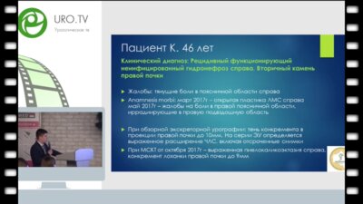 Амосов Н.А. - Лапароскопическая уретеропиелонеостомия при рецидивном гидронефрозе
