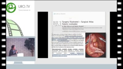Шпоть Е.В. - Формирование сферического эксцентрического ортотопического мочевого резервуара