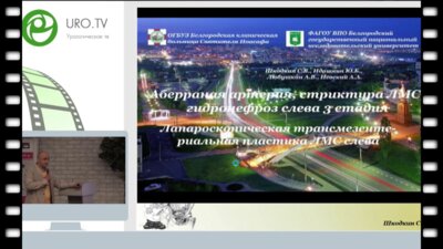 Шкодкин С.В. - Трансмезентериальный доступ в реконструкции лоханочно-мочеточникового сегмента