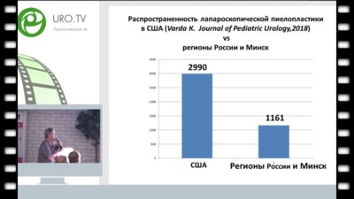 Бондаренко С.Г. - Лапароскопический доступ в детской урологии