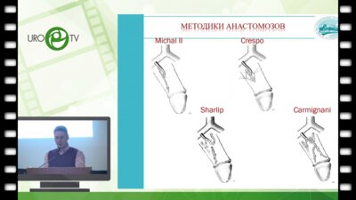 Абдулхамидов А.Н. - Реваскуляризация полового члена