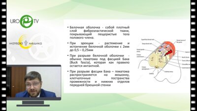 Беломытцев С.В. - Перелом полового члена