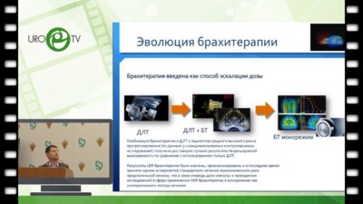 Цыбульский А.Д. - Возможности HDR брахитерапии в лечении рака простаты