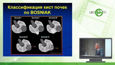 Рудин Ю.Э. - Резекция мультилокулярной кисты верхнего полюса правой почки у девочки 12 лет