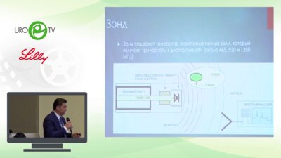 Чалый М.Е. - Первый опыт применения Trimprob в России