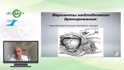 Шкодкин С.В. - Цистостома: установка, уход, прогноз