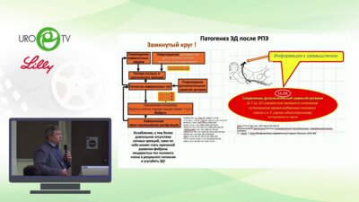 Новиков А.И. - Медикаментозная терапия эректильной дисфункции после радикальной простатэктомии