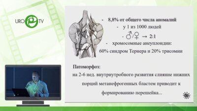 Прохоренко К.А. - Лапароскопическая хирургия опухолей подковообразной почки