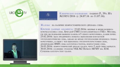 Шпоть Е.В. - Ретроперитонеоскопическая энуклеация опухоли почки