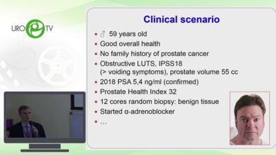 Говоров А.В. - Инцидентальный рак простаты. Развилки и варианты лечения