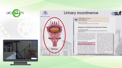 Еникеев Д.В.  - Осложнения малоинвазивных методов лечения рака простаты