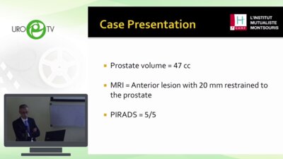 Eric Barret - Фокальная криоаблация. Focal Cryoablation