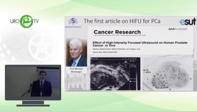 Ганжа Т.М. - Высокочастотная ультразвуковая аблация рака простаты. 15 лет опыта