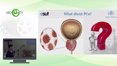 Марк Татаркин - Лазеры в хирургическом лечении рака простаты. Мечты или будущее