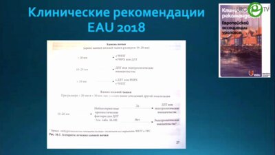 Амосов Н.А. - Возможности лапароскопической хирургии в лечении МКБ
