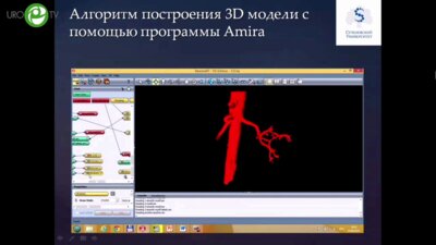 Шпоть Е.В. - Современные технологии в диагностике и лечении рака почки