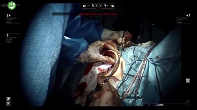 Волкан Тугчу - Робот -  ассистированная промежностная радикальная простатэктомия (Роботическая операционная)