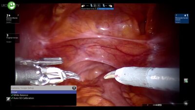 Антонио Гальфано - Ретциев спарринг РПЭ (Роботическая операционная)