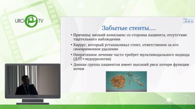 Обидняк В.М. - Забытые стенты современное решение проблемы