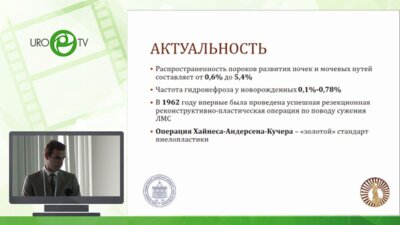 Доброседов Д.А. - Наш опыт изучения гидронефроза у детей лапароскопическим методом