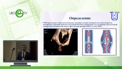 Гринь Е.А. - Собственный опыт применения динамической мультиспиральной компьютерной фармакокавернозографии