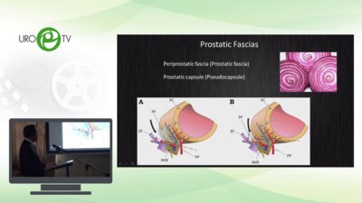 Фатих Атуг - Ретроградная нервосберешающая РПЭ