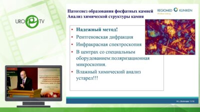 Штромаер Валтер Людвиг - Современное представление патогенеза фосфатного уролитиаза