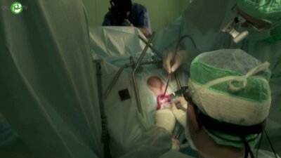 Живов А.В. - Пластика при структуре уретры